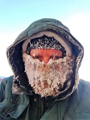 Noel Anderson's face covered in frost while walking in 33-degrees below zero.