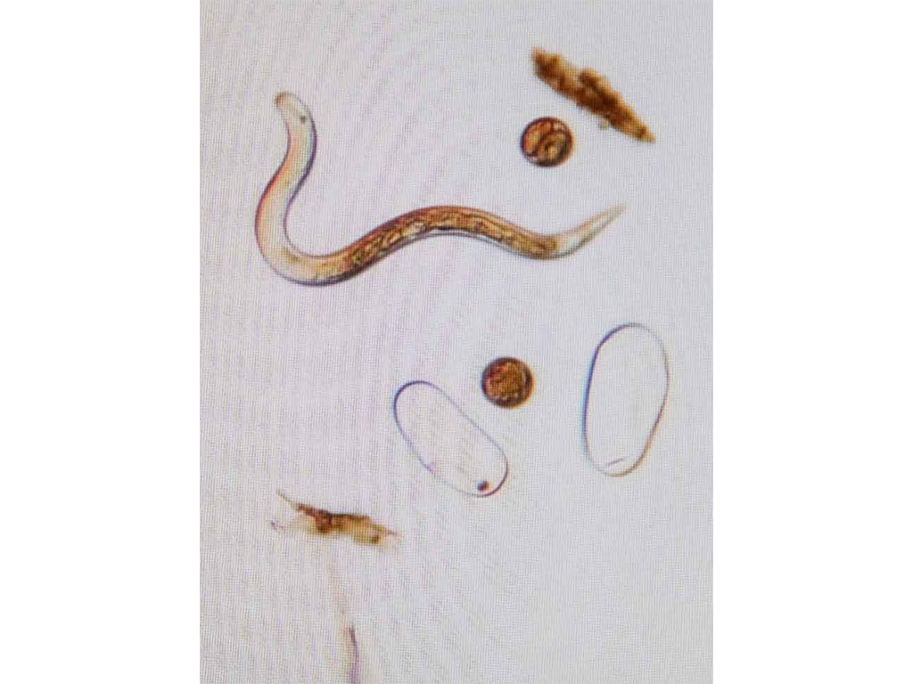 microscopic image of soybean cyst nematode organism